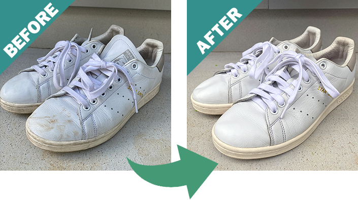 レザービフォーアフター